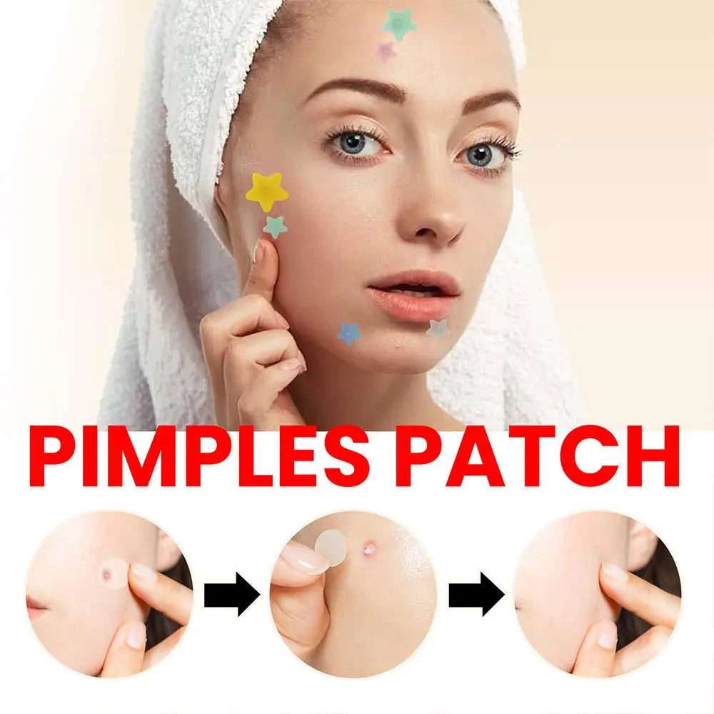 200 Patches Acnes Pimple Patches beunik